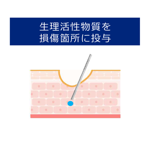 幹細胞培養上清液を使った治療2